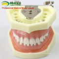 DENTAL04 (12563) Modelo anatômico Modelo Estudo Dental Modelos com goma macia